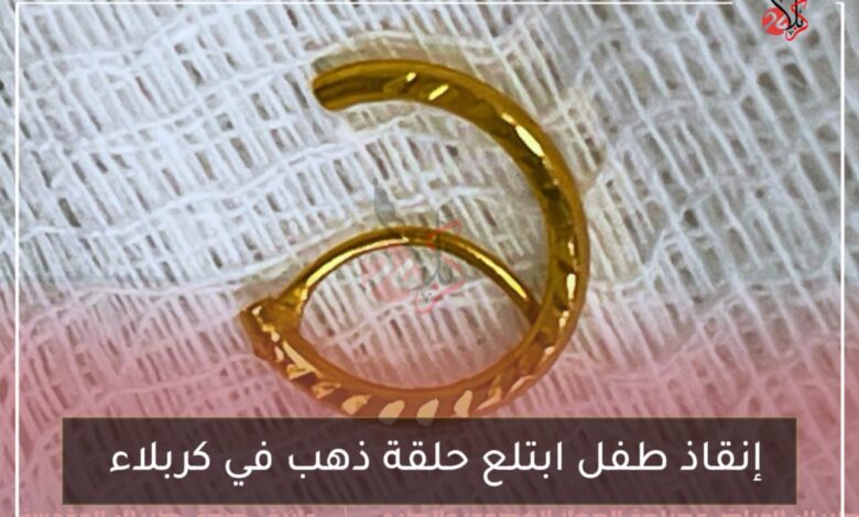 إنقاذ طفل ابتلع حلقة ذهب في كربلاء