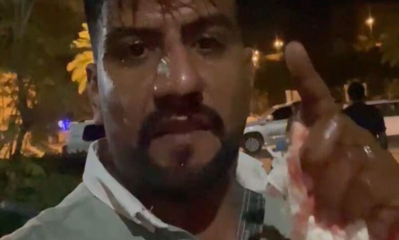 صور صادمة لصحفي من محافظة بابل والدماء تسيل من رأسه بعد تعرضه لإعتداء جسيم